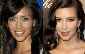 kim-kardashian-mira-el-antes-y-despues-de-l-3688_YitpONL-jpg_976x0
